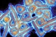 Virus Marburg Telan...