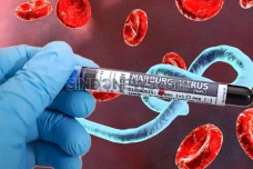 11 Gejala Penyakit Virus...