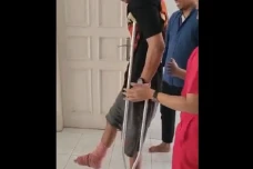 David Ozora Korban Penganiayaan...