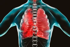 Epidemiolog Sebut Pneumonia...