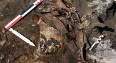 Sisa-sisa Kulit Manusia...