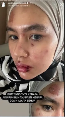 Kartika Putri Sedih...