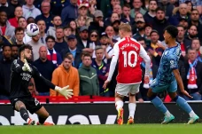 Mike Arteta Kecewa Arsenal...