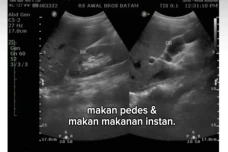 Kisah Pilu Wanita Idap...