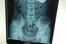Astaga! Dokter Temukan...