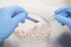 Stem Cell Mesenkimal...