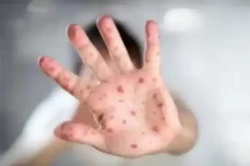 Viral Mitos Penyakit...