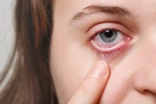 Mengenal Retinopati...