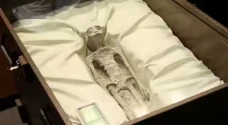 Bedah Tangan Mumi Alien...