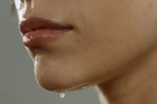 Apa Itu Hiperhidrosis?...