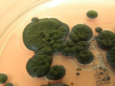 Jamur Cladosporium Sphaerospermum...
