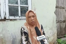 Gelar Operasi Bibir...