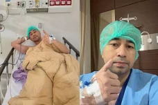 Raffi Ahmad Jalani Operasi...