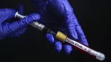 Awas, Virus Ebola Sudah...