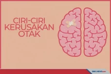 Sering Sakit Kepala?...