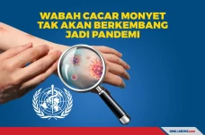 WHO: Wabah Cacar Monyet...