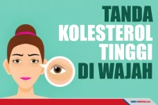 Tanda Kolesterol di...