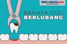 Jangan Anggap Sepele,...