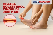 Waspada! Gejala Kolesterol...