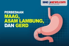 Serupa tapi Tak Sama,...