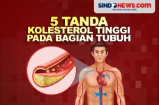 5 Tanda Bahaya Kolesterol...