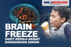 Mengenal Brain Freeze, Sakit...