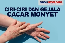 Ciri-Ciri dan Gejala...
