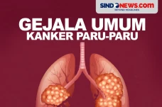 Gejala Kanker Paru yang...