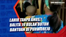 Lahir Tanpa Anus, Balita...