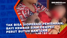 Tak Bisa Dioperasi Pemisahan,...