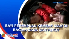 Bayi Perempuan Kembar...