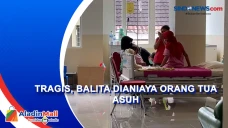 Tragis, Balita Dianiaya...
