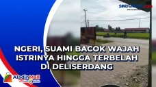 Ngeri, Suami Bacok Wajah...