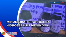 Balita Hidrosefalus...