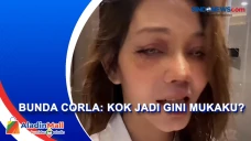 Unggah Foto Wajah Lebam...