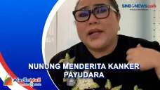 Komedian Nunung Srimulat...