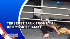 Pemotor Alami Luka Lecet...