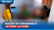 Miris! Tulang Hidung...