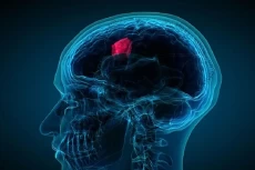 2 Gejala Awal Tumor...
