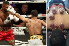 Amir Khan Kalah TKO...