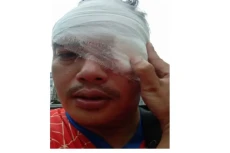 Wartawan TV Swasta Dipukul...