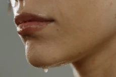 Apa Itu Hiperhidrosis?...