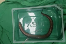 Heboh! Dokter Temukan...