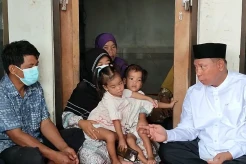 Segera Jalani Operasi Pemisahan, Begini Penampakan Bayi Kembar Siam Inaya dan Anaya