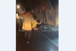Ngeri! Main HP saat Berkendara, Pemotor Tergilas Bus hingga Kaki Hancur dan Usus Terburai
