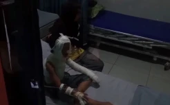 Asyik Makan Es Asap, Ayah dan Anak di Ponorogo Mendadak Terbakar
