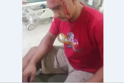 Gerombolan Pengamen di Exit Tol Pemalang Keroyok Sopir Mobil Boks hingga Bonyok