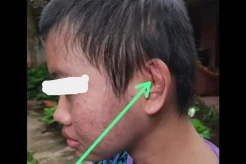 Diduga Korban Penganiayaan...