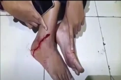 Ngeri! OTK Lempar Bom Molotov ke Asrama Mahasiswa di Makassar, 1 Mahasiswi Terluka