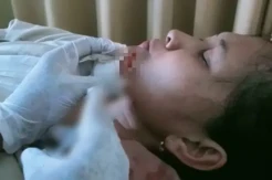 Terkena Benang Layangan, Wajah 2 Mahasiswa di Sampang Luka Parah